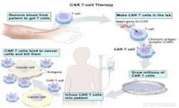 India Celebrates Its First Locally Developed CAR T-Cell Therapy For Treatment Of Cancer